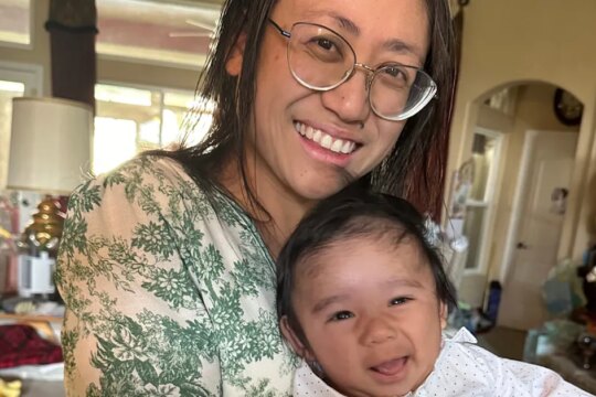 Doctors Deliver Surprise Baby While Removing Mom's 22-Pound Cyst