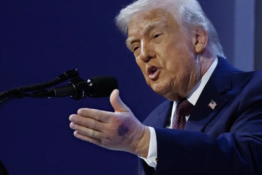 Donald Trump Has Yet Another Hand Bruise -- And A Sketchy Excuse